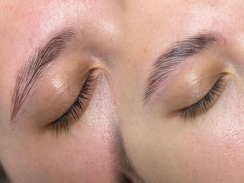 Lash lift & Brow lift - Podizanje trepavica & Laminacija obrva